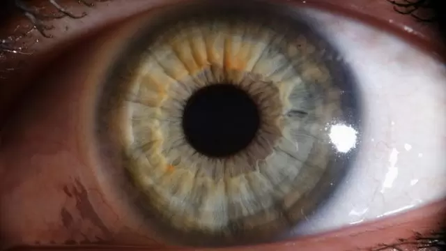 НОВАЯ ПАРАДИГМА: ГЛАЗНЫЕ ПРОБИОТИКИ ДЛЯ ЛЕЧЕНИЯ СУХОСТИ ГЛАЗ И ХРОНИЧЕСКОГО КОНЪЮНКТИВИТА